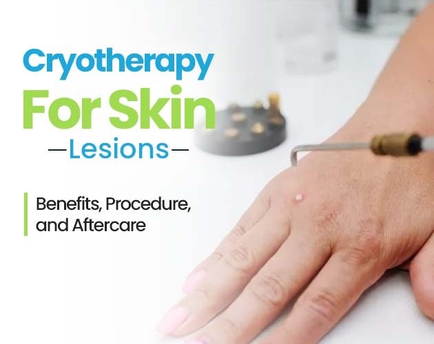5 Amazing Benefits of Cryotherapy You Need to Know
